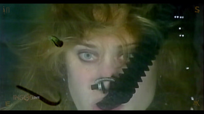 Leeches!