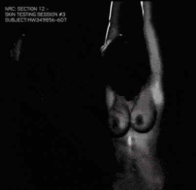 NRC SKIN TEST VIDEO SEGMENT.gif