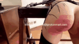 welts2222.gif