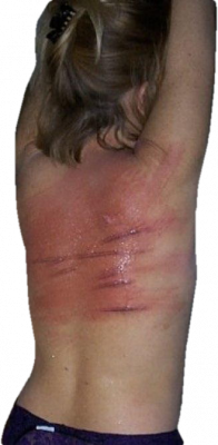 whipwound004.png